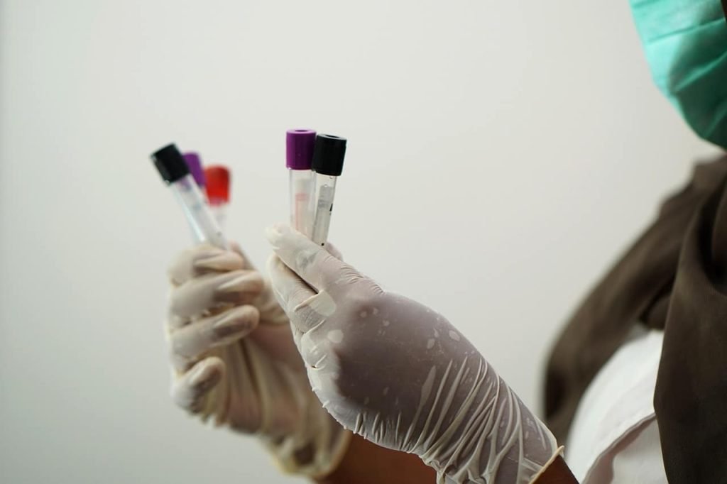 sangue, exame, laboratório
