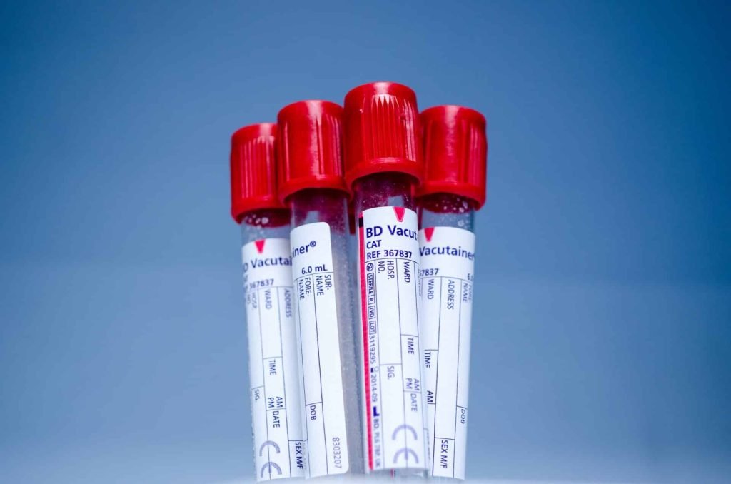group-technology-tube-red-equipment-human-977887-pxhere.com