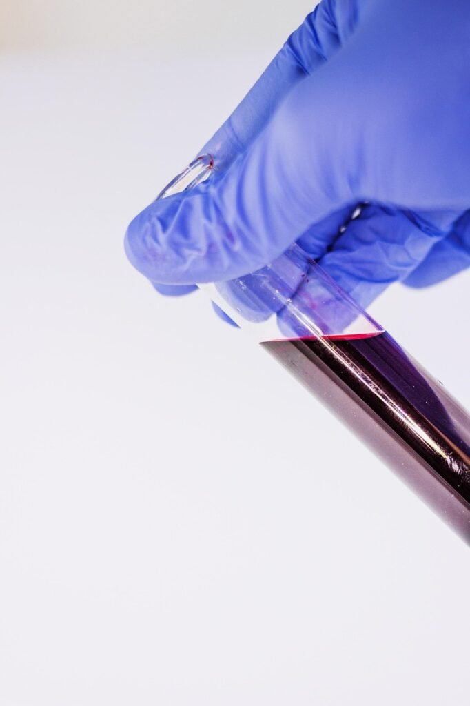 sangue, exame, laboratório, hiv, covid